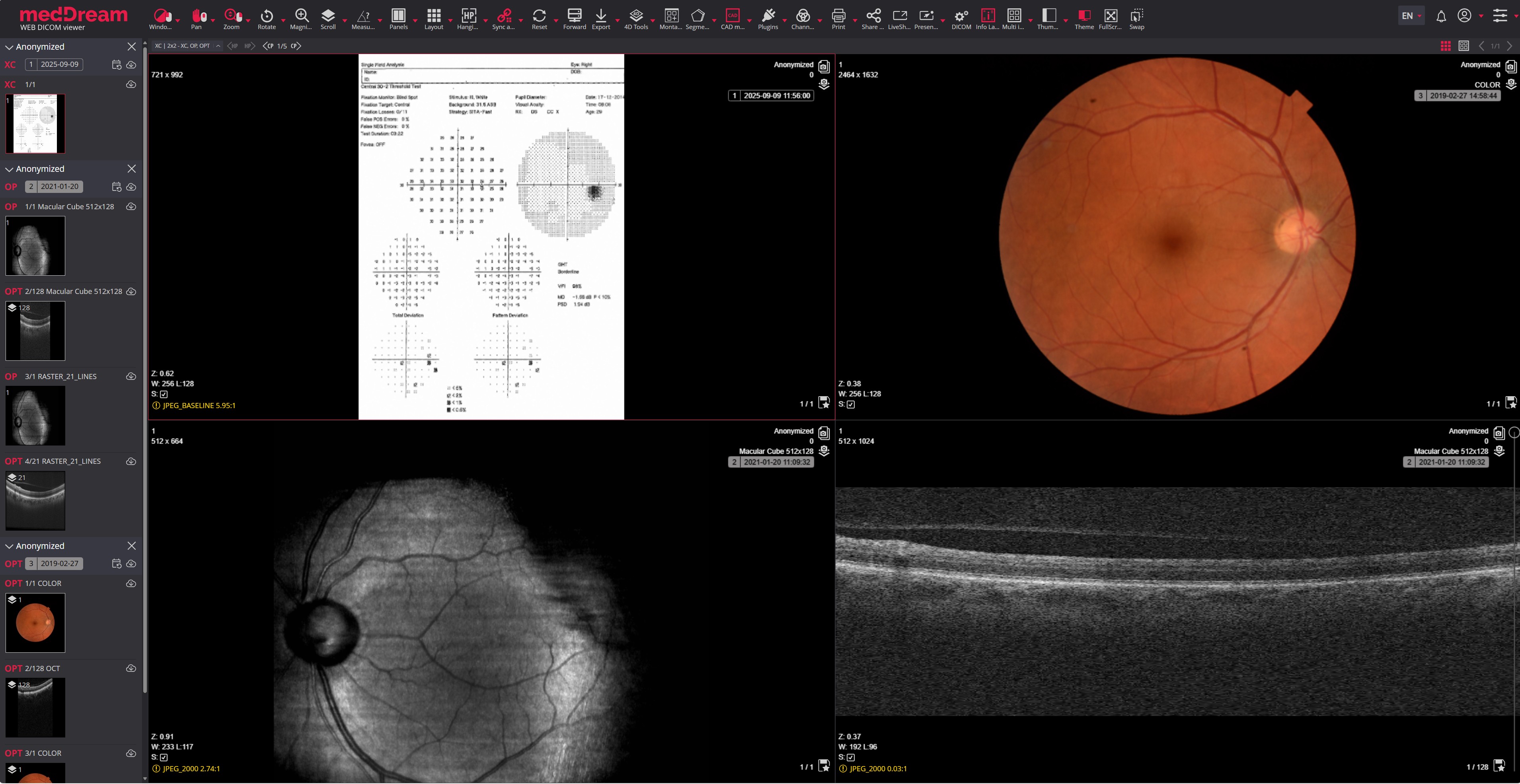 Meddream Viewer
